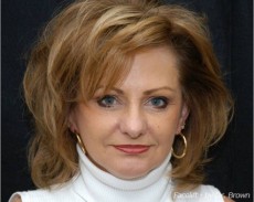 After facelift front view female patient case 2882