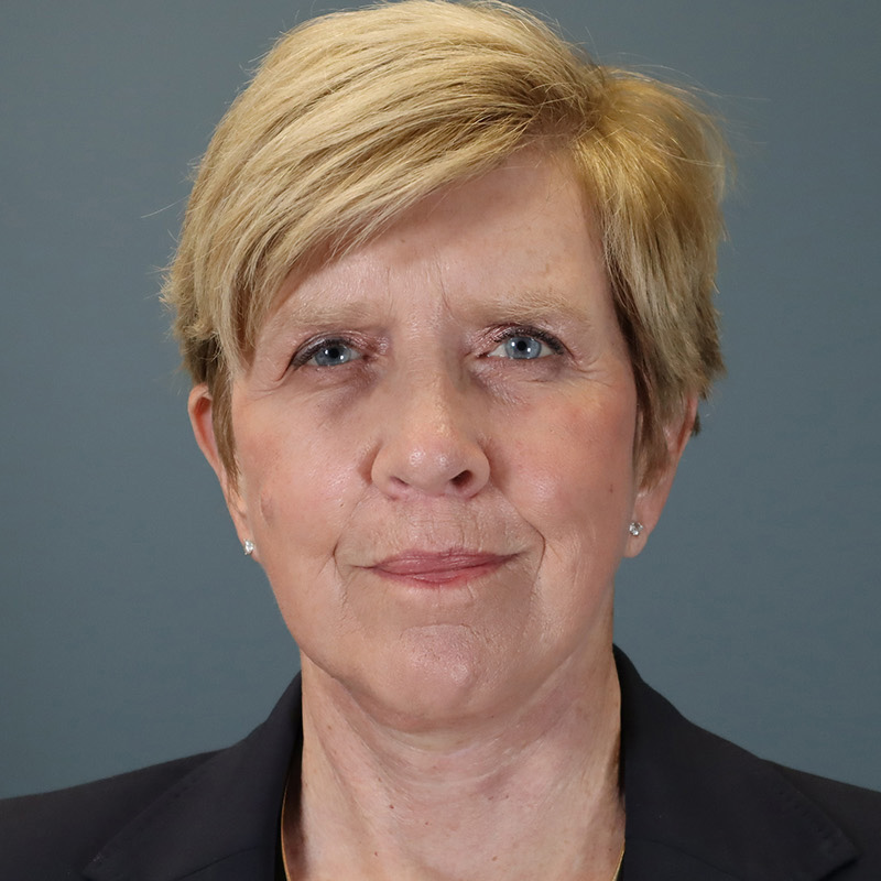 after facelift front view female patient case 5052